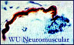 WU neuromuscular